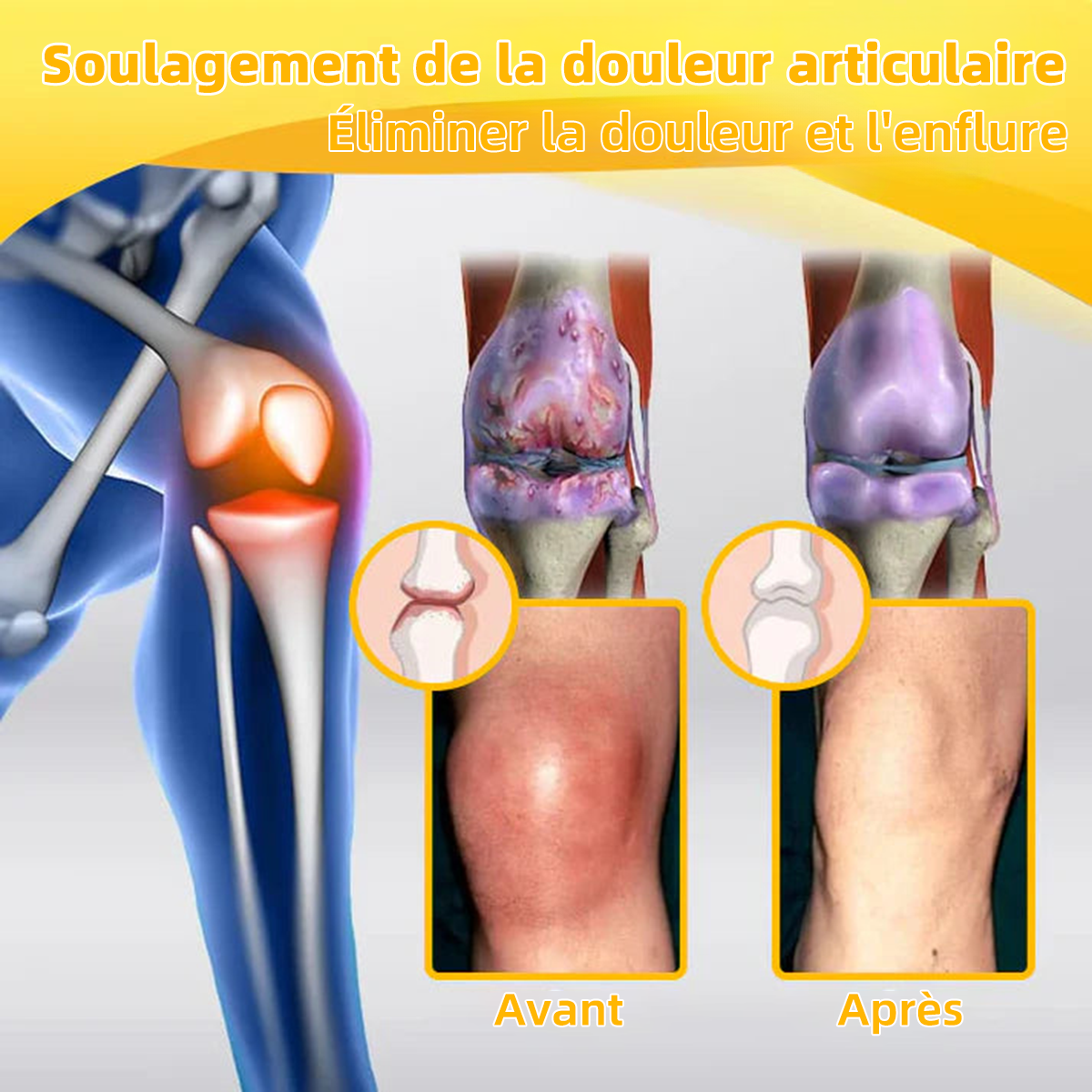 🐝ArthroFree™ Crème de guérison osseuse à soulagement de la douleur au venin d'abeille (Spécialement conçue pour les personnes âgées et recommandée par la Société Française d'Orthopédie et de Traumatologie - SOFCOT)🌸