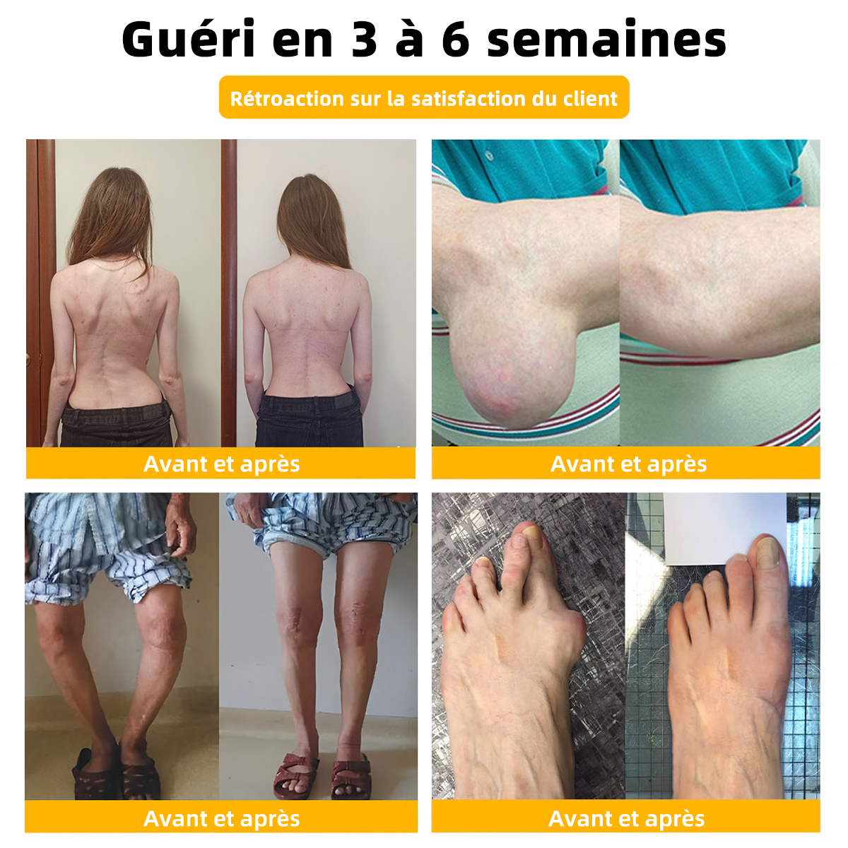 🐝ArthroFree™ Crème de guérison osseuse à soulagement de la douleur au venin d'abeille (Spécialement conçue pour les personnes âgées et recommandée par la Société Française d'Orthopédie et de Traumatologie - SOFCOT)🌸